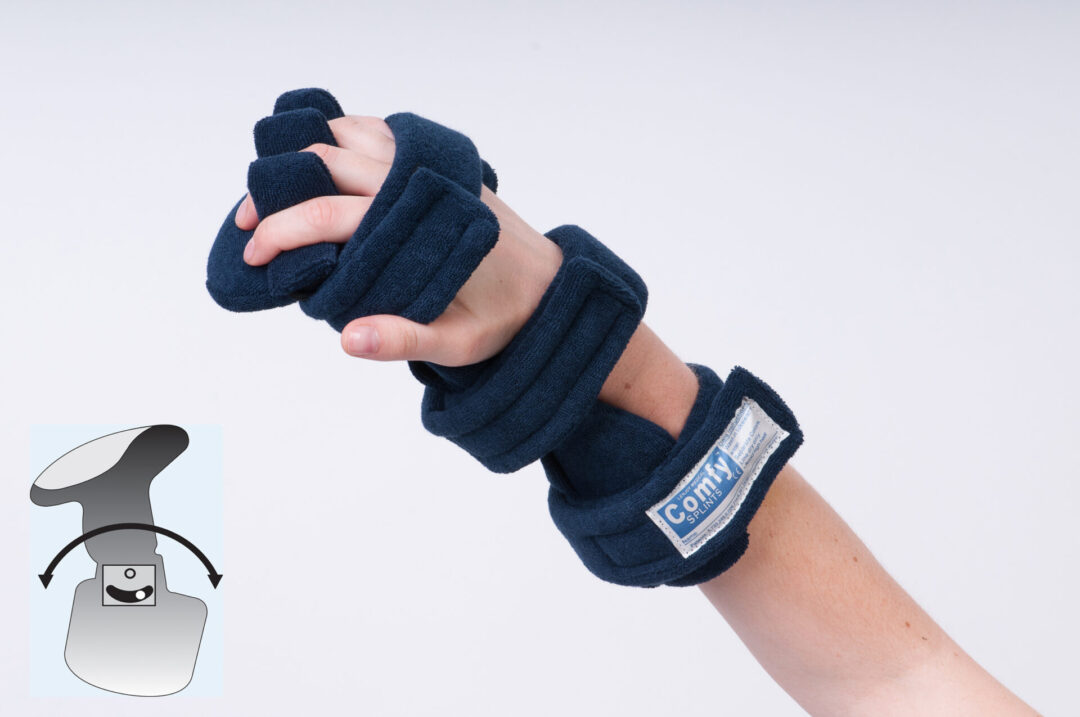 ComfySplints™ Deviation Hand Models | Comfy Splints